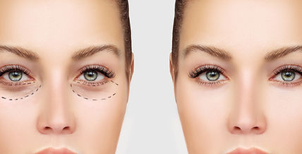 Before and After Surgery
