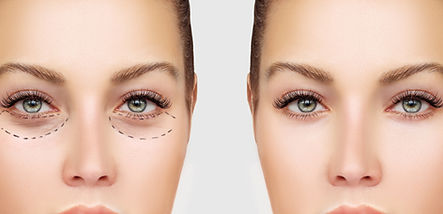 Before and After Surgery