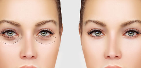 Before and After Surgery