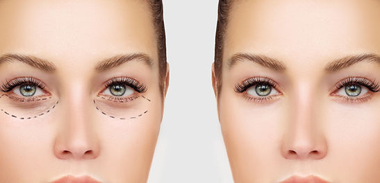Before and After Surgery