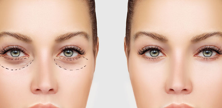 Before and After Surgery