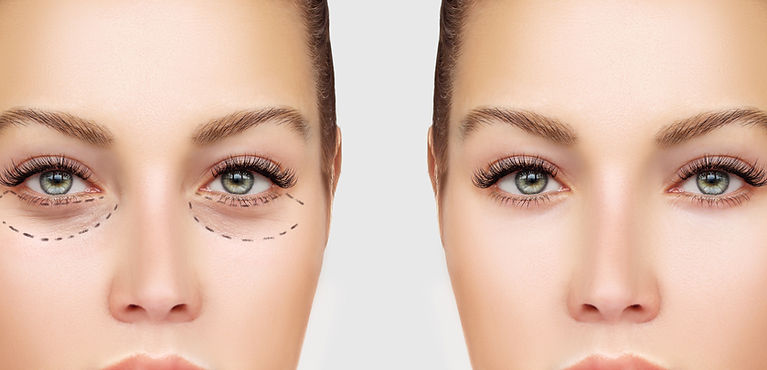 Before and After Surgery