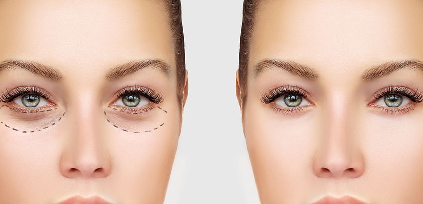 Before and After Surgery
