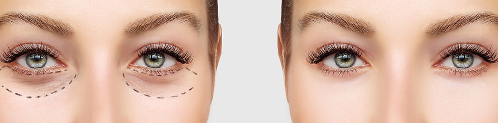 Before and After Surgery