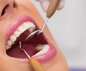 dentist-examining-female-patient-teeth.jpg
