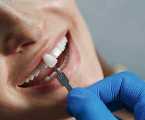 dentist-whiting-teeth.jpg