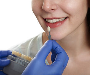 color-test-patient-s-teeth.jpg