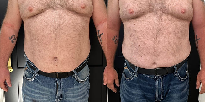 Thinnr-Before-After-6-BEFORE-AND-AFTER.jpg