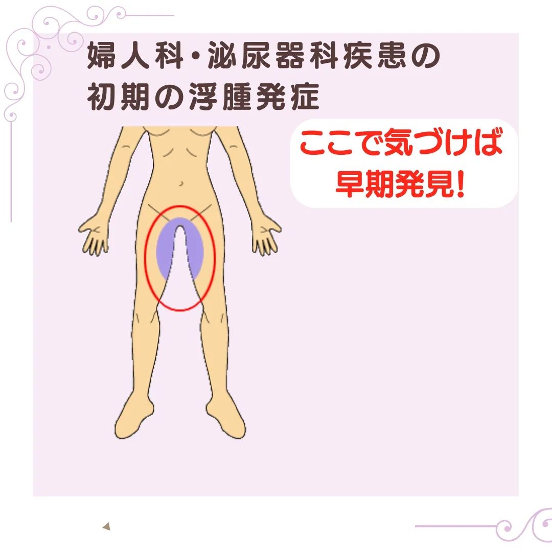 17867721872865763.webp