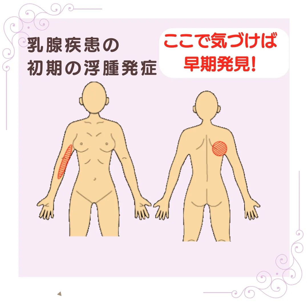 17981209667109757.webp