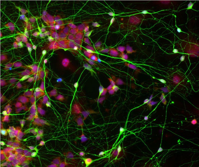 "Human neural stem cells (shown in red), originally reprogrammed from adult skin cells, differentiate efficiently into brain cells (shown in green), after being cultured with star-shaped cells called astrocytes." Photo credit: Chen Lab, Penn State University via Pen State News