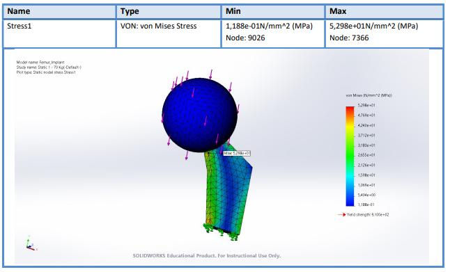 Femur Implant Stress Analysis at 70kg Load