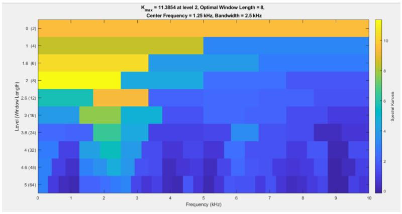 Spectral Kurtosis Analysis