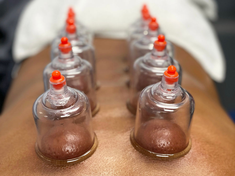 Cupping Therapy