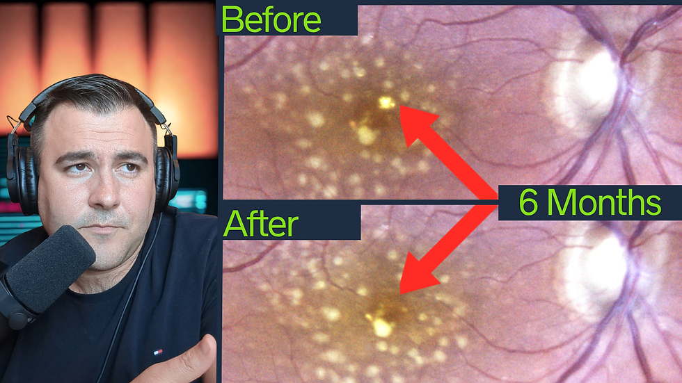 Revolutionizing Eye Health: The Impact of Photobiomodulation on Vision, Ep 1
