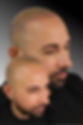 Scalp-Micropigmentation.jpeg