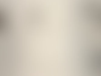 Close-up of a metal audio device panel labeled "SURGEON 25," featuring multiple input/output jacks labeled 15VDC, 1L, 2R.