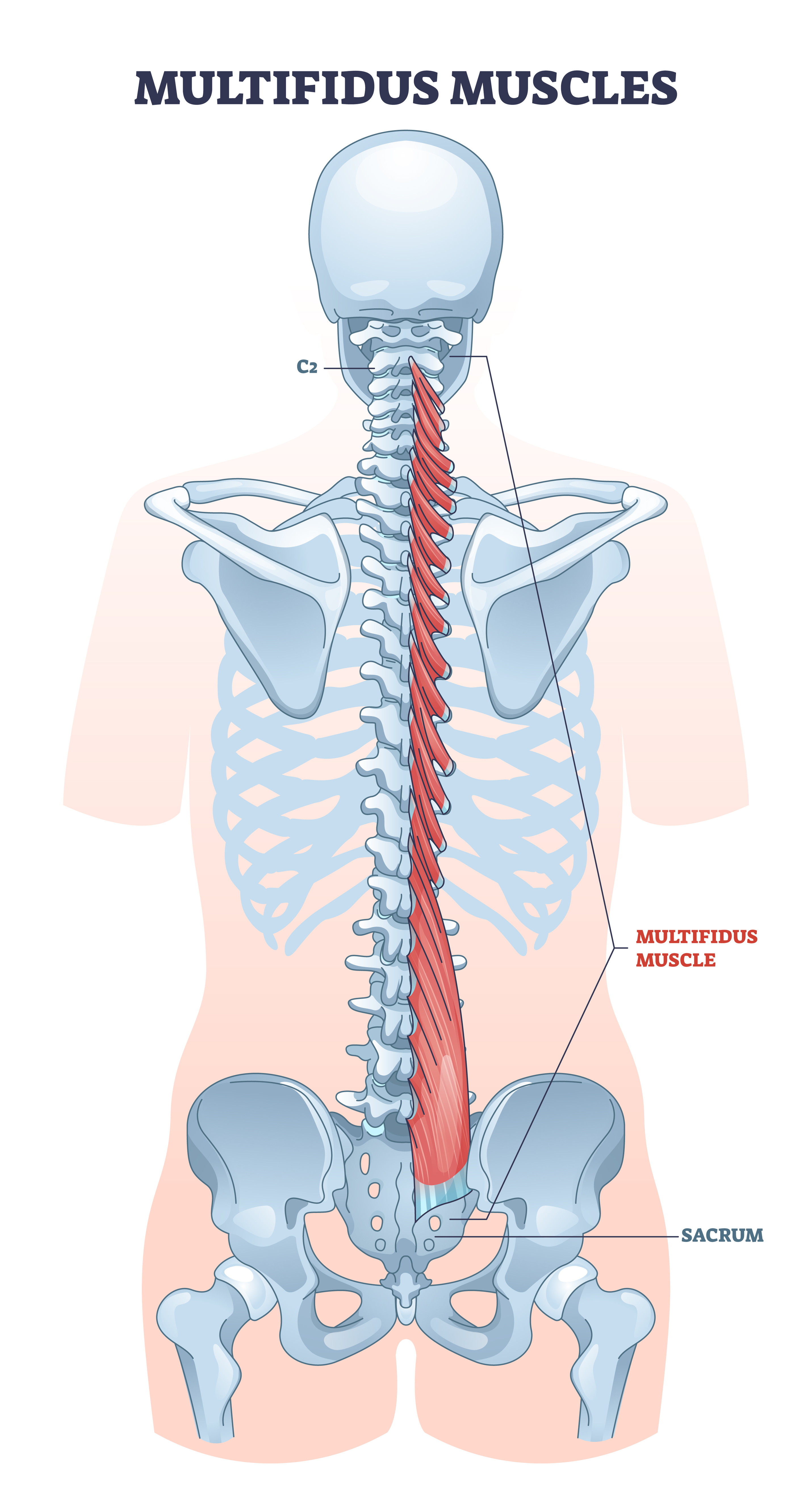 Detailed illustration highlighting the multifidus muscle, an essential core stabilizer muscle responsible for spinal stability and posture.