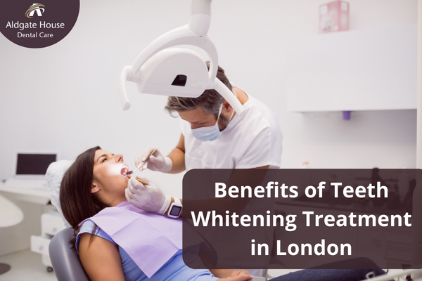 Benefits of Teeth Whitening Treatment in London