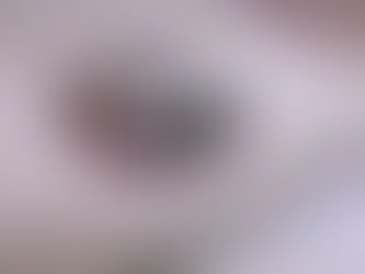 How Can GN BODYDOCTOR Automatic Kegel Exercise Device Improve Pelvic Health for Women?