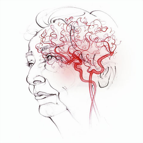 profile-elderly-woman-brain-blood-vessels_edited.jpg