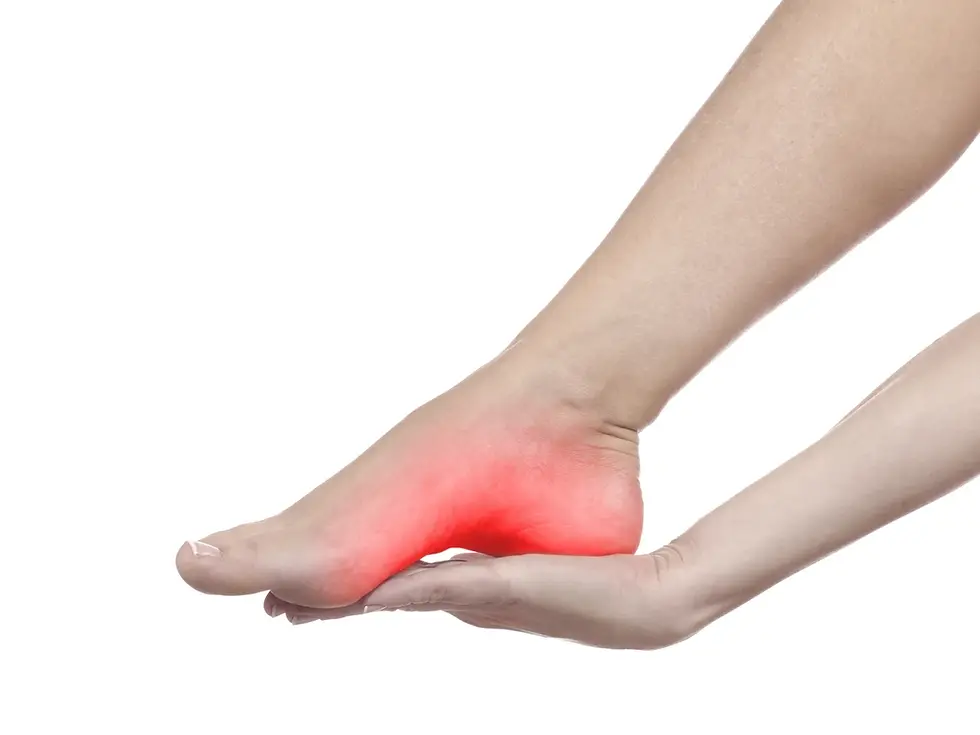 pé inflamado com fascite plantar