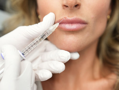 Dermal Fillers Miami