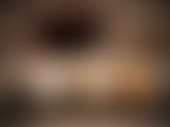 Por que as lentes de resina podem manchar com o tempo?