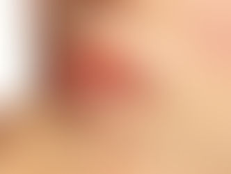 Contorno Labial