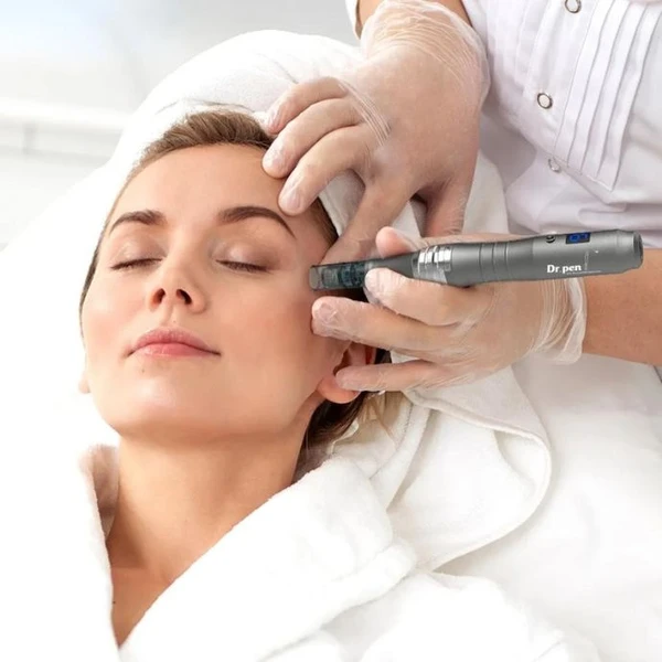 Microneedling Treatment on client