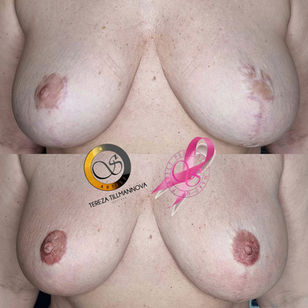 Tetování Areol Royal Esthetic