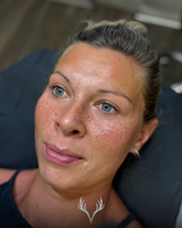 Fake Freckles
