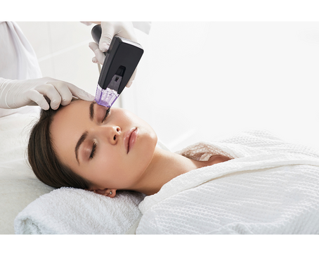 Morpheus8 – besser als Microneedling?