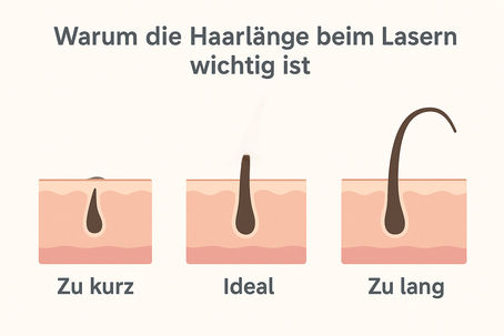 Warum die Haarlänge beim Lasern so entscheidend ist – und wann du wirklich rasieren solltest.