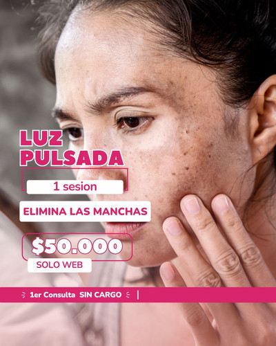 Cara Luz Pulsada Manchas Contraindicaciones Piel DepilaciÃ³n Luz