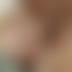 נצמד לאמא - על חרדת זרים 