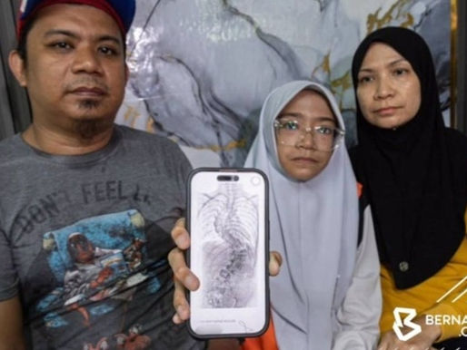 Fadhlina bantu kos pembedahan skoliosis remaja 13 tahun