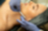 Effective facial hair removal service for smooth and hair-free skin.