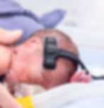 preterm neonate of 970 g with OxyPrem NOAH sensor