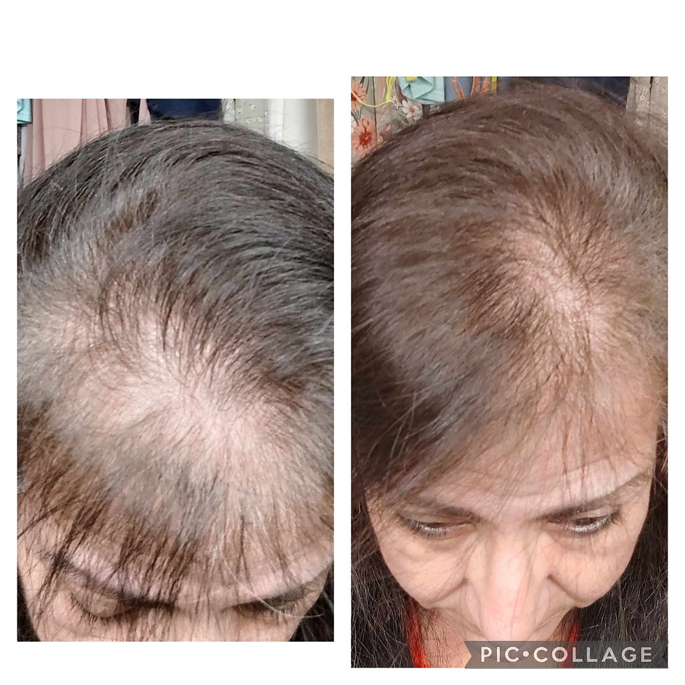 Thumbnail: Hair Tonic