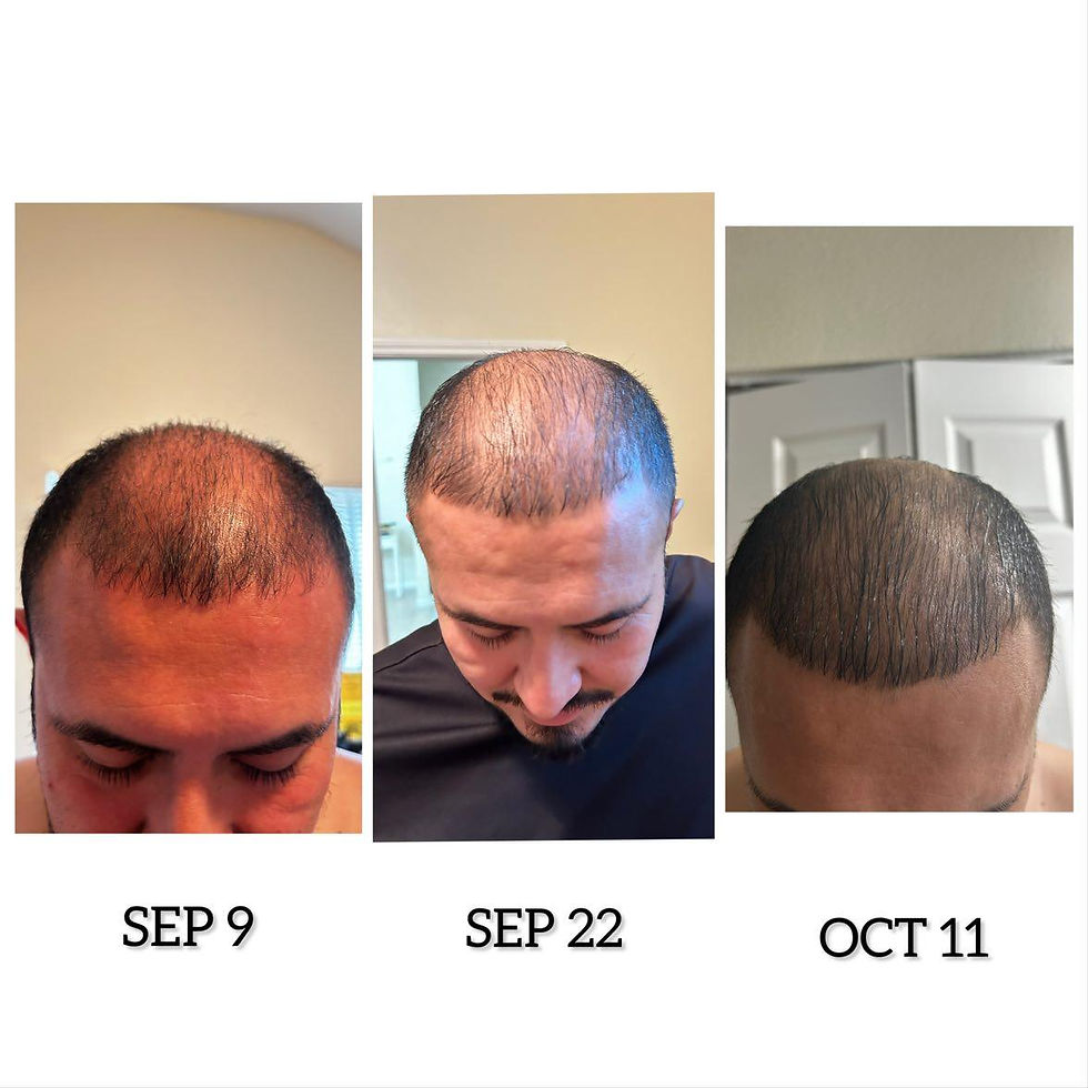 Thumbnail: Hair Tonic