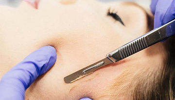 dermaplaning_at_a_salon-e1528811960932.jpg