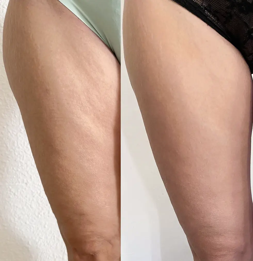 Thumbnail: Body Sculpting Cream - SPA Salonnepro - alle huidtypen (150 ml)