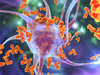 autoimmune disease