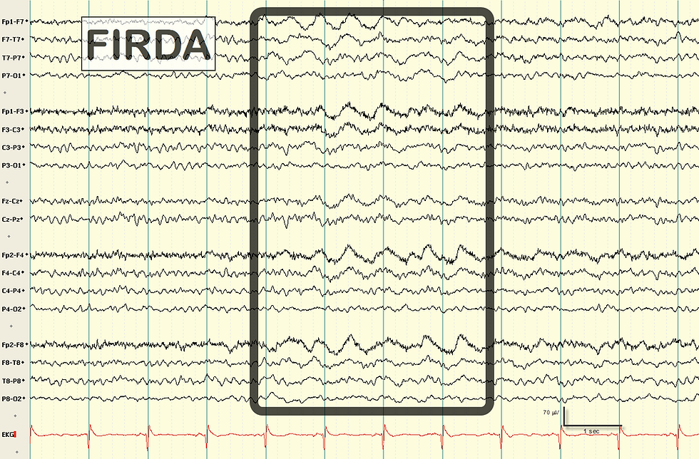 FIRDA