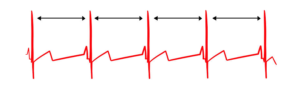low variability