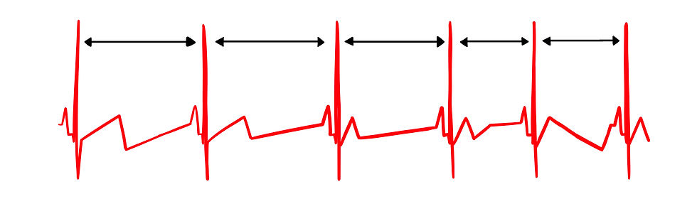 healthy variability
