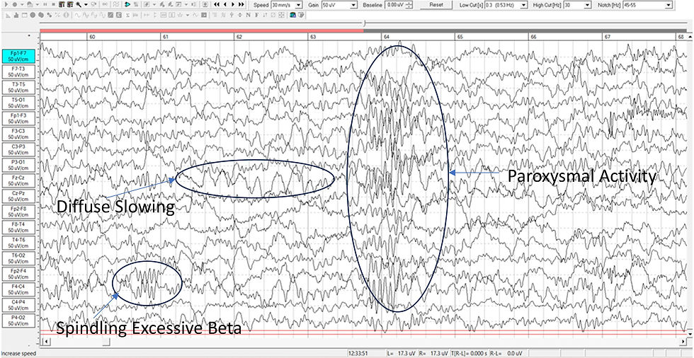 diffuse slowing