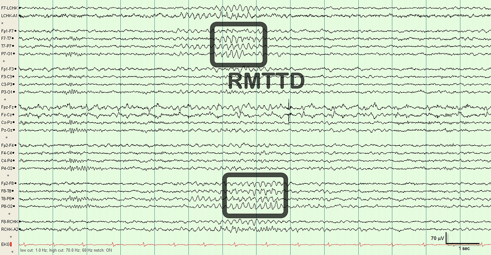 RMTTD