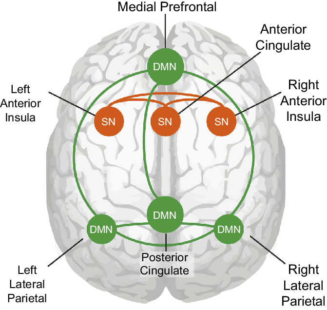 salience network and default network